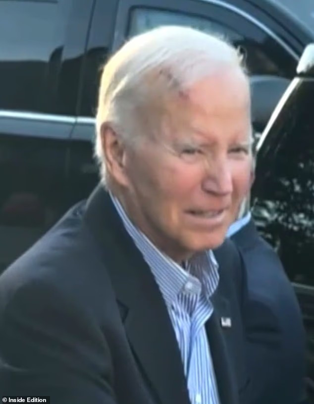 Cựu Tổng thống Biden xuất hiện với vết sẹo lớn trên trán. Ảnh: Inside Edition. biden2.png