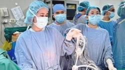 Đau bụng âm ỉ, người bệnh 64 tuổi mắc hai ung thư cùng lúc